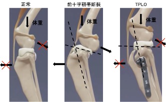 TPLOのリスク・合併症・失敗？！犬の前十字靭帯断裂の手術：TPLOで脛骨粗面の骨折【脛骨粗面】 - 日本の獣医師が米国獣医外科専門医を目指す